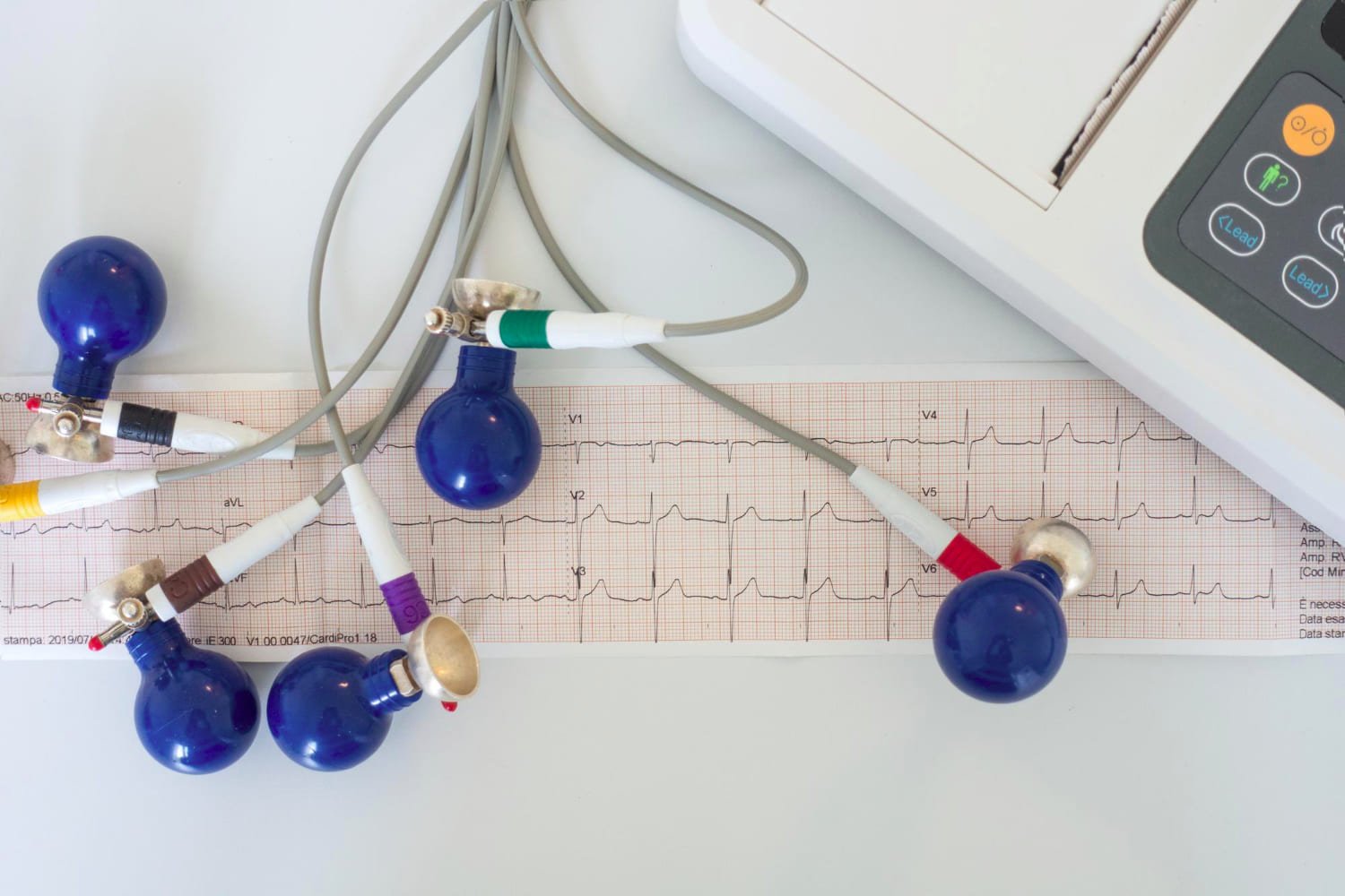 Electrocardiograma de 12 derivaciones